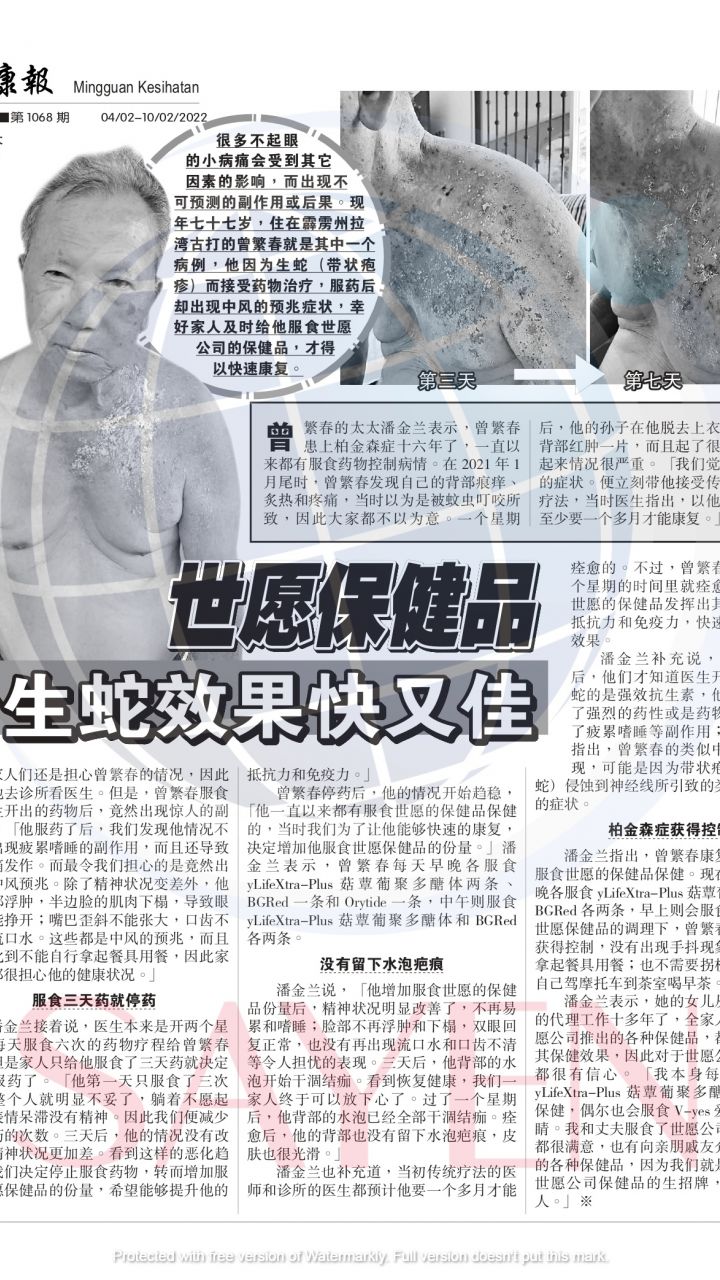 1068 曾繁春 Chen Fung Choon 《严重疱疹-生蛇，16年的帕金森病》