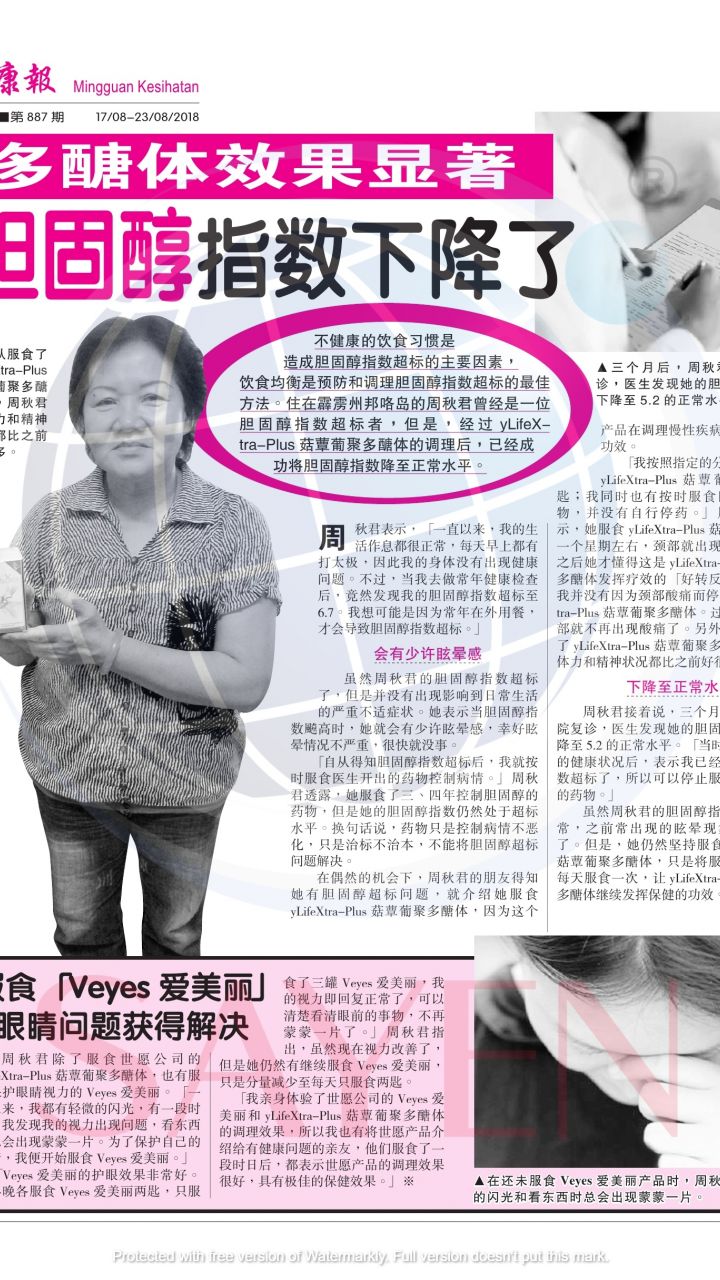 887--周秋君---高胆固醇与视力差