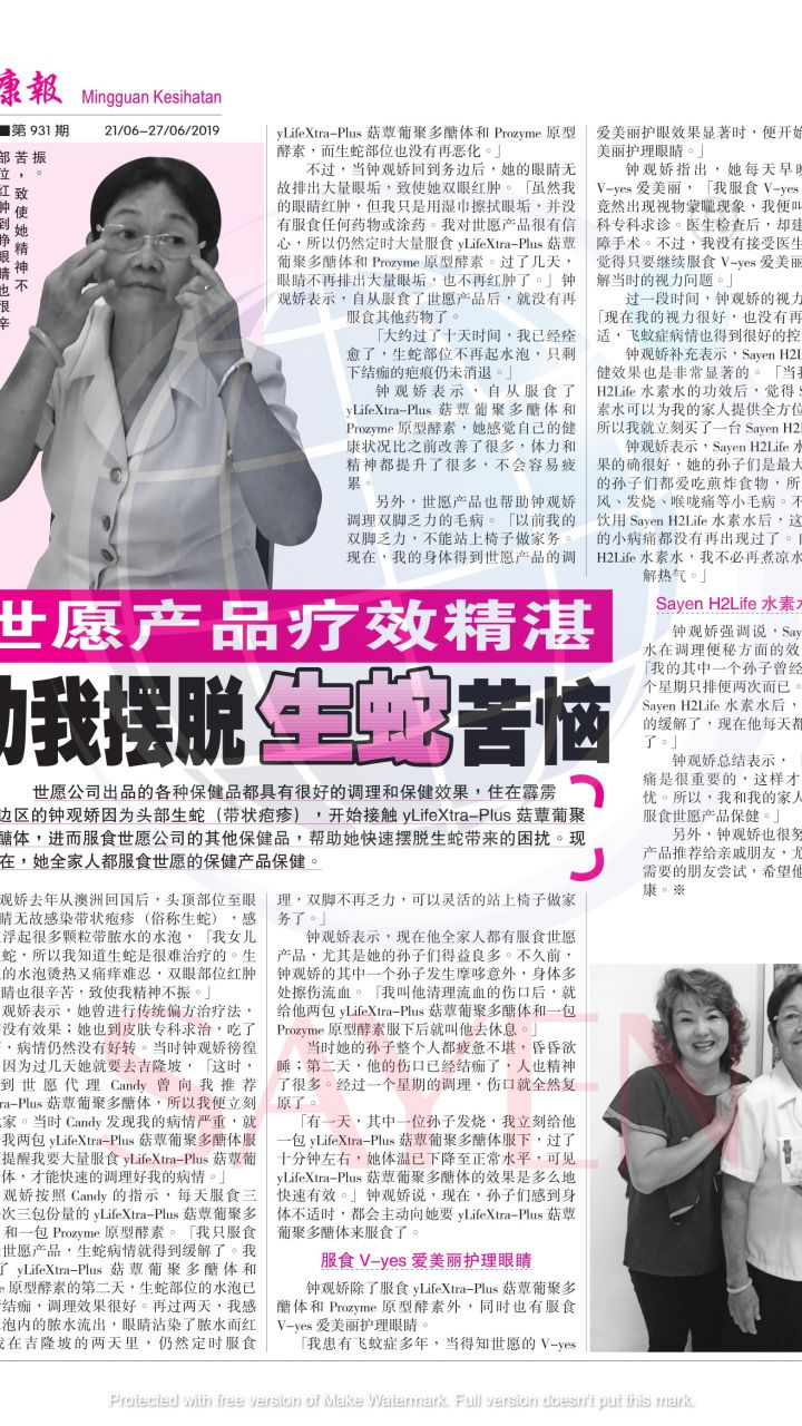 931 钟观娇 - 头顶生蛇，影响眼睛肿痛