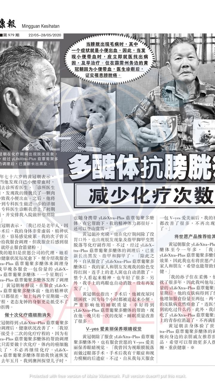 979 黄冠朝 - 前列腺癌，精神疲累，干眼症，老人斑